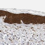 AHNAK2 Antibody in Immunohistochemistry (Paraffin) (IHC (P))