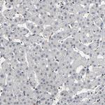 AHNAK2 Antibody in Immunohistochemistry (IHC)