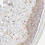 TAF10 Antibody in Immunohistochemistry (Paraffin) (IHC (P))