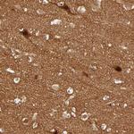 NEMF Antibody in Immunohistochemistry (Paraffin) (IHC (P))