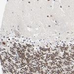 SALL2 Antibody in Immunohistochemistry (Paraffin) (IHC (P))