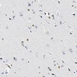 SALL2 Antibody in Immunohistochemistry (Paraffin) (IHC (P))