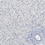 SALL2 Antibody in Immunohistochemistry (Paraffin) (IHC (P))
