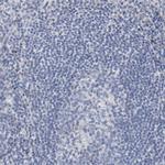 SALL2 Antibody in Immunohistochemistry (Paraffin) (IHC (P))