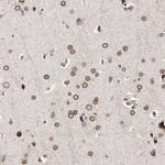 CCDC175 Antibody in Immunohistochemistry (Paraffin) (IHC (P))