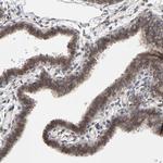 CCDC175 Antibody in Immunohistochemistry (Paraffin) (IHC (P))