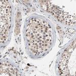 CCDC175 Antibody in Immunohistochemistry (Paraffin) (IHC (P))