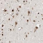 DAZAP1 Antibody in Immunohistochemistry (Paraffin) (IHC (P))