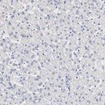 FGFBP1 Antibody in Immunohistochemistry (Paraffin) (IHC (P))
