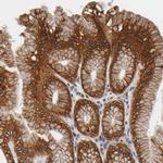 ASB6 Polyclonal Antibody