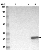 GSTA1 Antibody in Western Blot (WB)