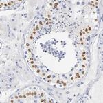 SOCS7 Antibody in Immunohistochemistry (Paraffin) (IHC (P))