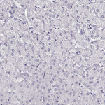MAGEC1 Antibody in Immunohistochemistry (Paraffin) (IHC (P))