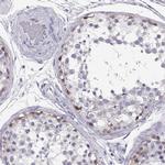 MAGEC1 Antibody in Immunohistochemistry (IHC)