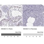 MAGEC1 Antibody
