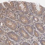 STRN3 Antibody in Immunohistochemistry (Paraffin) (IHC (P))
