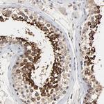 DDX10 Antibody in Immunohistochemistry (Paraffin) (IHC (P))