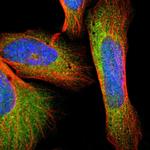 GSTZ1 Polyclonal Antibody