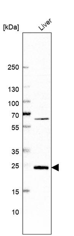 GSTZ1 Antibody in Western Blot (WB)
