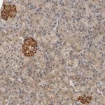 SCAP Antibody in Immunohistochemistry (Paraffin) (IHC (P))