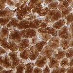 SCAP Antibody in Immunohistochemistry (Paraffin) (IHC (P))