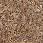 SCAP Antibody in Immunohistochemistry (IHC)