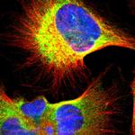 UCKL1 Polyclonal Antibody