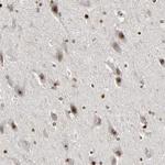 CPN2 Antibody in Immunohistochemistry (Paraffin) (IHC (P))