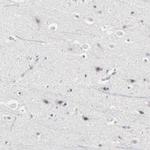 PDLIM3 Antibody in Immunohistochemistry (Paraffin) (IHC (P))