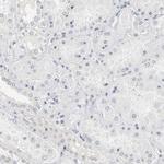 PDLIM3 Antibody in Immunohistochemistry (Paraffin) (IHC (P))