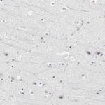 PDLIM3 Antibody in Immunohistochemistry (IHC)