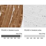 PDLIM3 Antibody