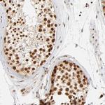 ILKAP Antibody in Immunohistochemistry (IHC)