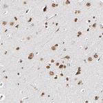 ILKAP Antibody in Immunohistochemistry (IHC)