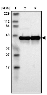 ILKAP Antibody in Western Blot (WB)
