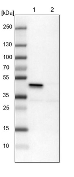 ILKAP Antibody in Western Blot (WB)