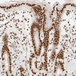 ILKAP Antibody in Immunohistochemistry (IHC)