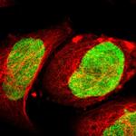 ILKAP Polyclonal Antibody