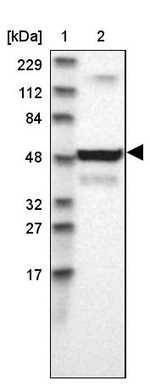 UCKL1 Antibody in Western Blot (WB)