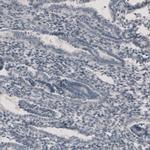 CT83 Antibody in Immunohistochemistry (IHC)