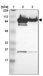 AKAP8 Antibody in Western Blot (WB)