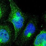 DRIL1 Polyclonal Antibody