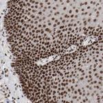 ETV3 Antibody in Immunohistochemistry (Paraffin) (IHC (P))