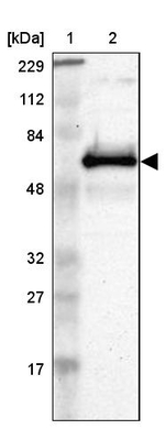 ETV3 Antibody in Western Blot (WB)
