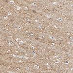SLC10A2 Antibody in Immunohistochemistry (Paraffin) (IHC (P))