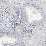 SLC10A2 Antibody in Immunohistochemistry (Paraffin) (IHC (P))