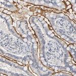 SLC10A2 Polyclonal Antibody