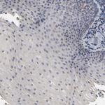 SLC10A2 Antibody in Immunohistochemistry (Paraffin) (IHC (P))