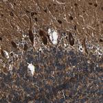 C1orf198 Antibody in Immunohistochemistry (Paraffin) (IHC (P))