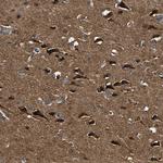 C1orf198 Antibody in Immunohistochemistry (Paraffin) (IHC (P))